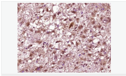 605411b3ccf22.png image.png