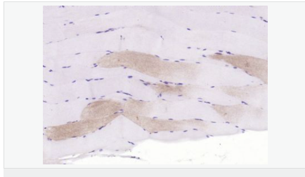 605416d56c2aa.png image.png