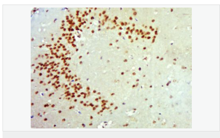 6058125e542bb.png image.png