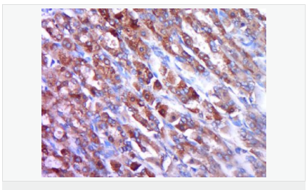 605943b35c1df.png image.png