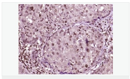 60595227c3f49.png image.png