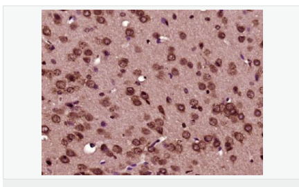 60595e6c64d7b.png image.png