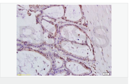 607647ccab6e3.png image.png