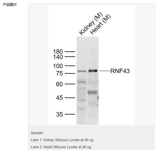 607d19642a115.png image.png